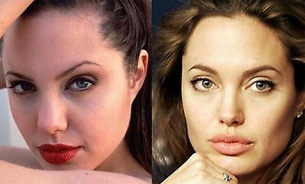 plastic surgery 14 Top 16 Celebrities Before and Ater Plastic Surgery