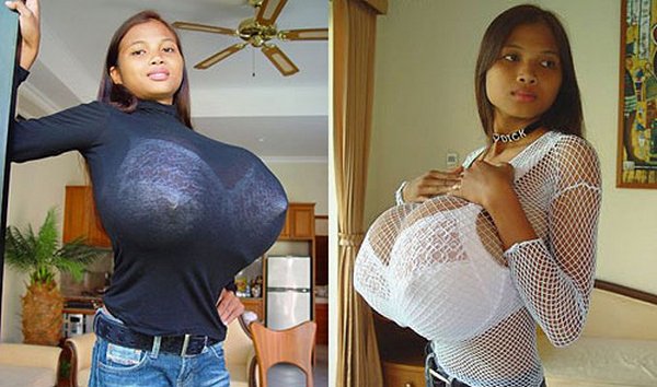 The biggest breasts in the world has Chinese Ting Hia Fen . Each of ...