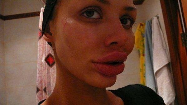 freakish girls 13 Freakish Girls Blessed With Plastic Surgery   Scary!