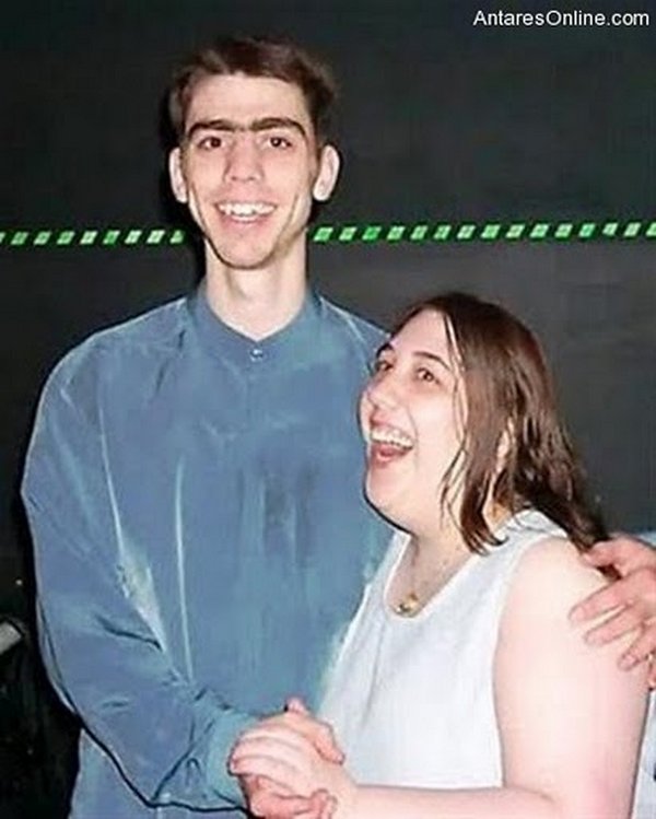ugly couples 12 15 Most Ugly Couples In The World