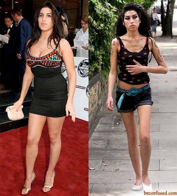 celebrities before and now 01 20 Celebrities Before And After Fame