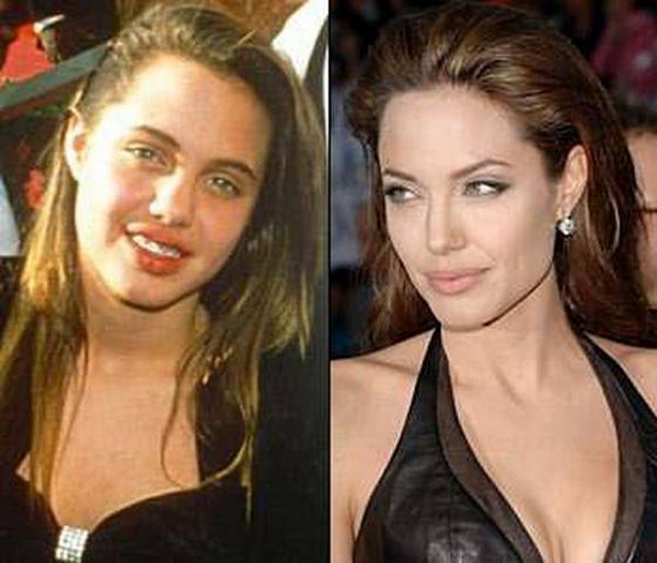 stars before and after makeup. celebrities before and now 02