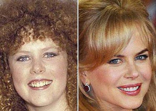 celebrities before and now 04 20 Celebrities Before And After Fame