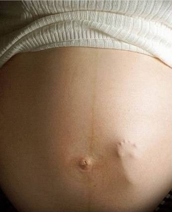 8 Very Strange Facts About Pregnancy