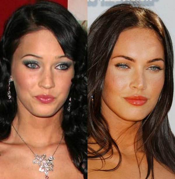plastic surgery 09 Top 16 Celebrities Before and Ater Plastic Surgery