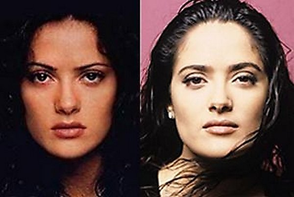 plastic surgery 11 Top 16 Celebrities Before and Ater Plastic Surgery