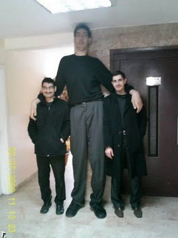 tallest man 08 Meet Sultan Kosen From Turkey   The Worlds Tallest Man 81(2.47 meter)