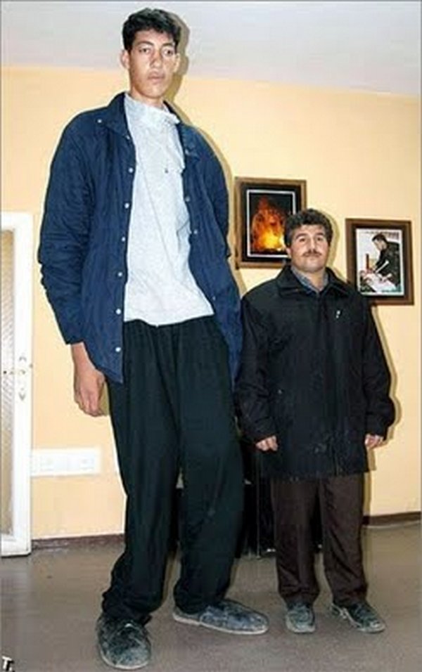 tallest man 09 Meet Sultan Kosen From Turkey   The Worlds Tallest Man 81(2.47 meter)