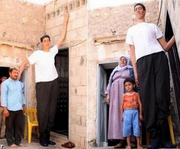 tallest man 11 Meet Sultan Kosen From Turkey   The Worlds Tallest Man 81(2.47 meter)