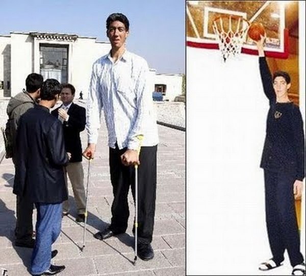 tallest man 12 Meet Sultan Kosen From Turkey   The Worlds Tallest Man 81(2.47 meter)