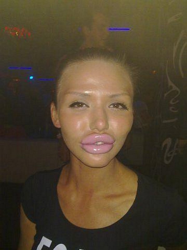 freakish girls 11 Freakish Girls Blessed With Plastic Surgery   Scary!