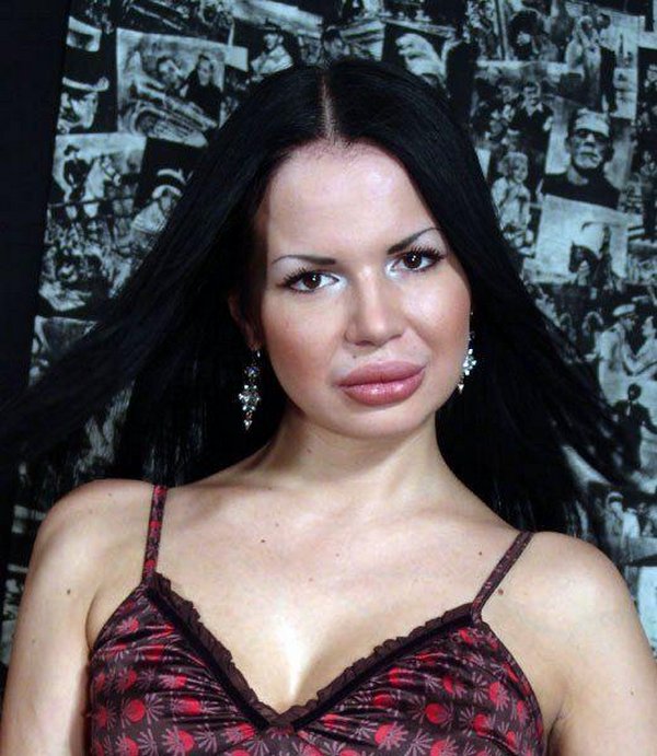 freakish girls 17 Freakish Girls Blessed With Plastic Surgery   Scary!