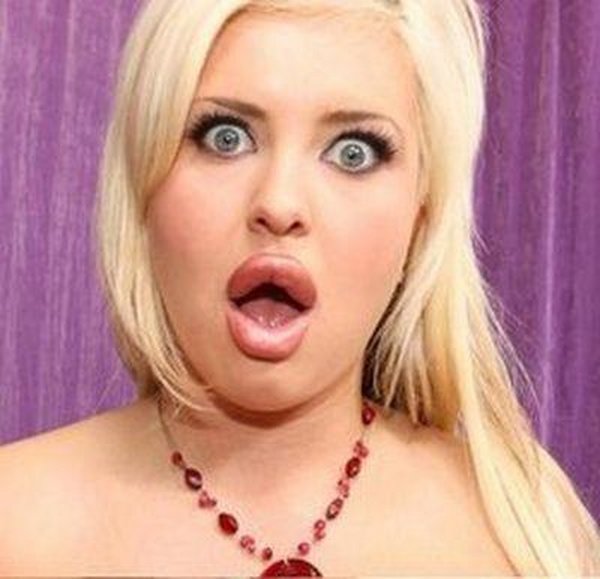 freakish girls 20 Freakish Girls Blessed With Plastic Surgery   Scary!