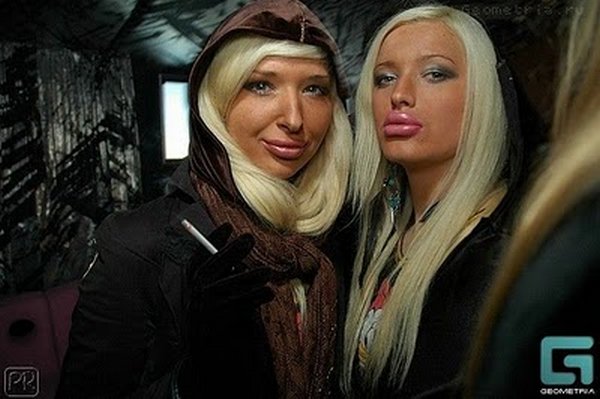freakish girls 26 Freakish Girls Blessed With Plastic Surgery   Scary!