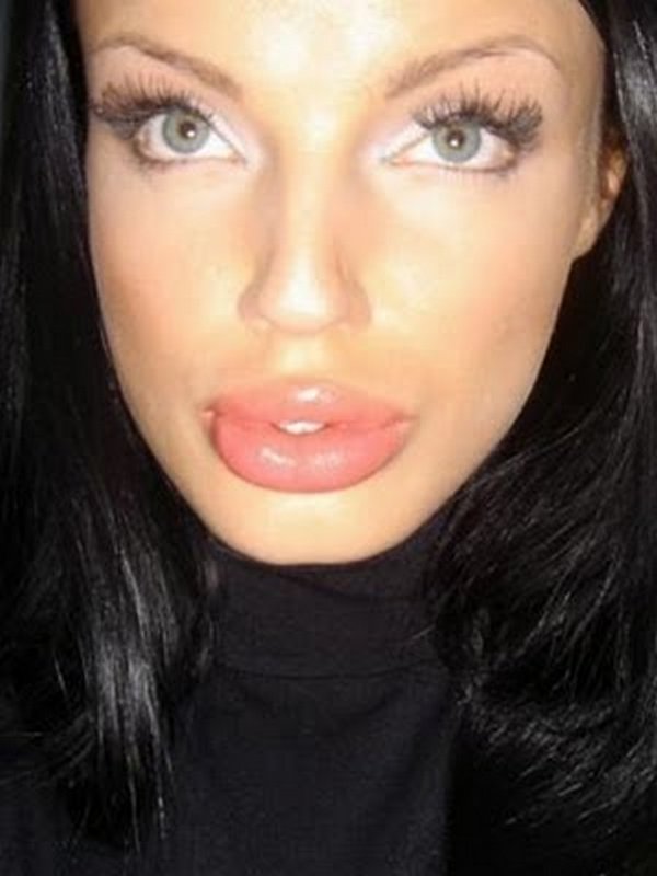freakish girls 38 Freakish Girls Blessed With Plastic Surgery   Scary!