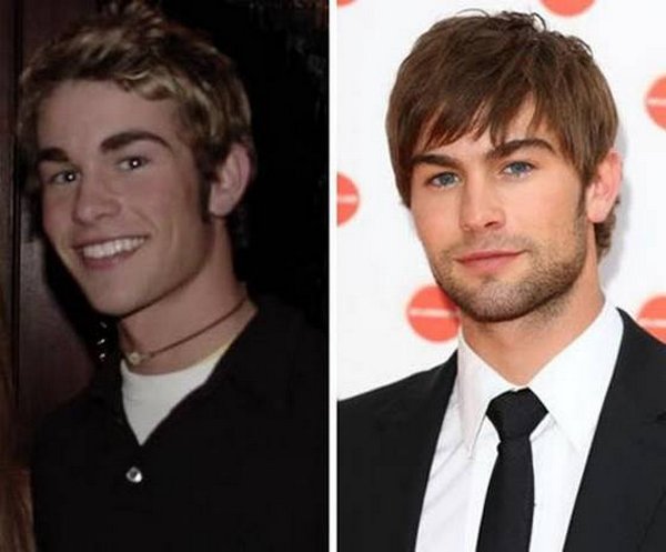 celebrities before and now 06 20 Celebrities Before And After Fame