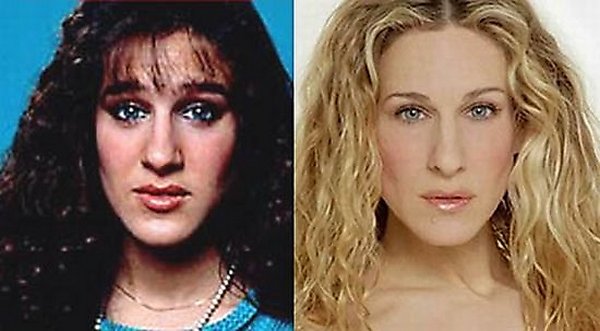 Top 16 Celebrities Before and Ater Plastic Surgery